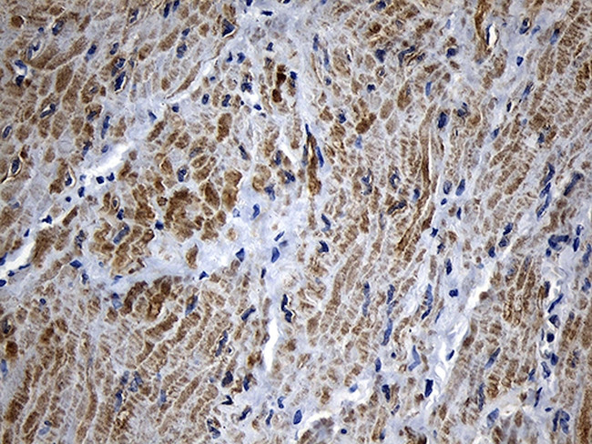 MYL1 Antibody in Immunohistochemistry (Paraffin) (IHC (P))