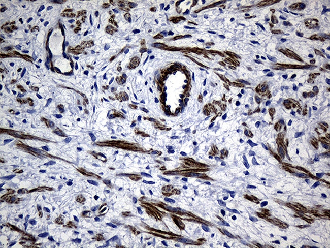 MYL1 Antibody in Immunohistochemistry (Paraffin) (IHC (P))