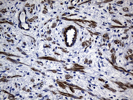 MYL1 Antibody in Immunohistochemistry (Paraffin) (IHC (P))