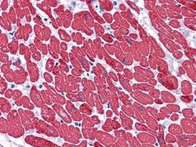 MYL3 Antibody in Immunohistochemistry (Paraffin) (IHC (P))
