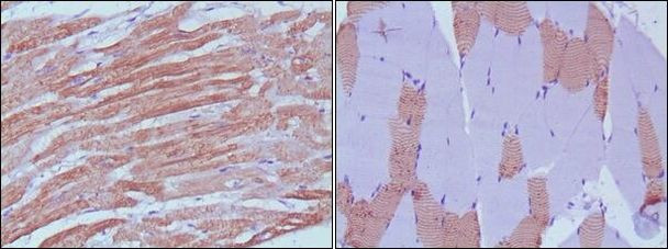 MYL3 Antibody in Immunohistochemistry (Paraffin) (IHC (P))