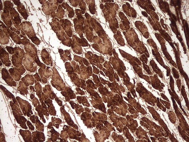 MYL4 Antibody in Immunohistochemistry (Paraffin) (IHC (P))