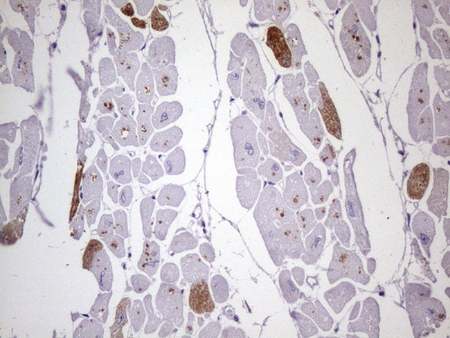 MYL4 Antibody in Immunohistochemistry (Paraffin) (IHC (P))