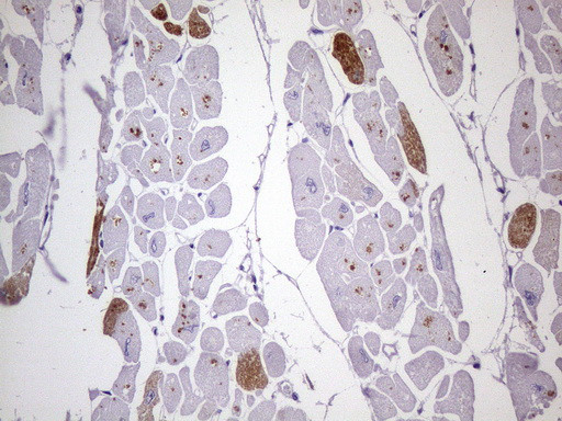 MYL4 Antibody in Immunohistochemistry (Paraffin) (IHC (P))