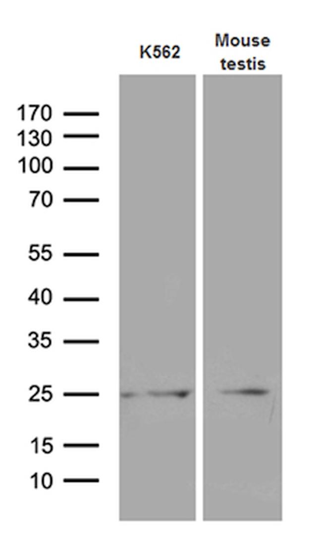 MYL6B Antibody in Western Blot (WB)