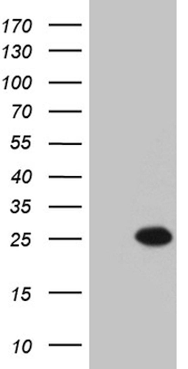 MYL6B Antibody in Western Blot (WB)