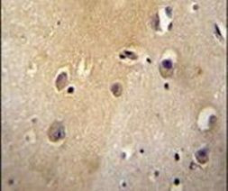 MYLIP Antibody in Immunohistochemistry (IHC)