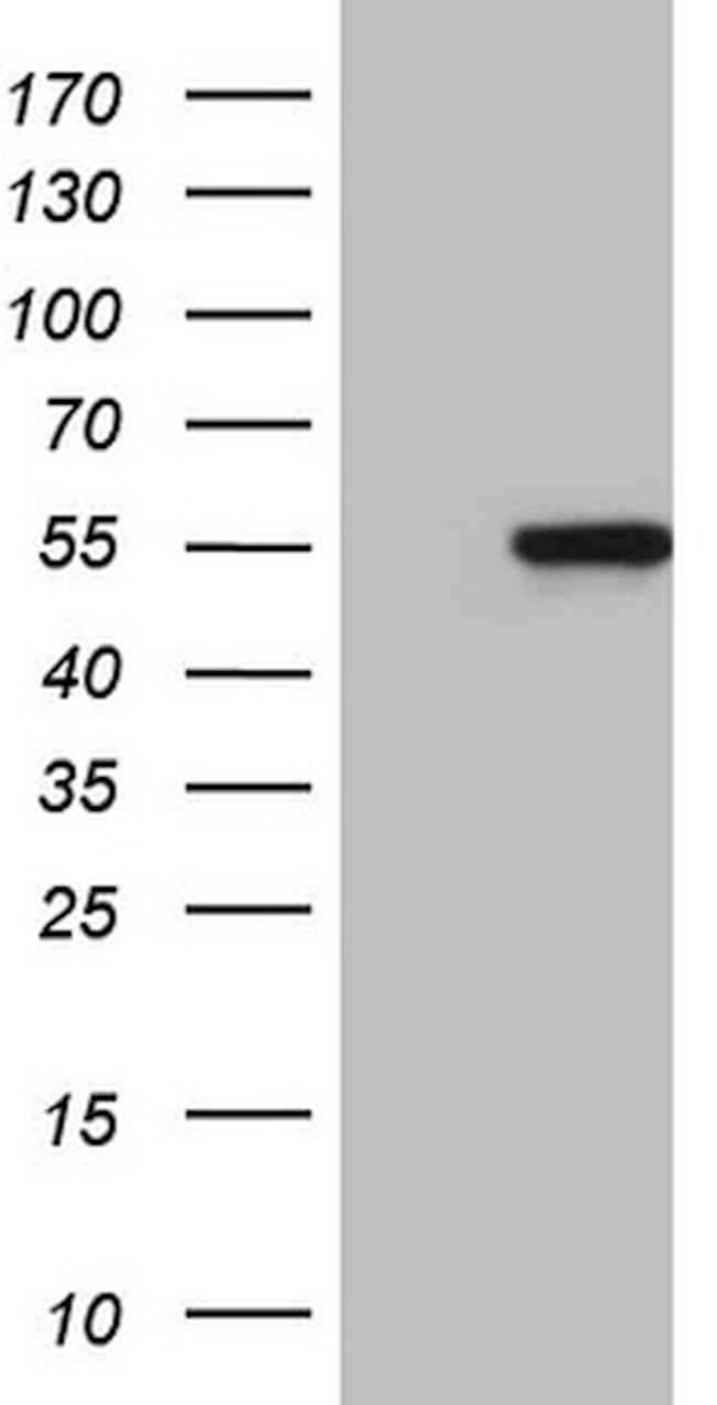 MYLIP Antibody in Western Blot (WB)