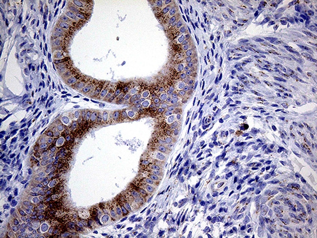MYOT Antibody in Immunohistochemistry (Paraffin) (IHC (P))