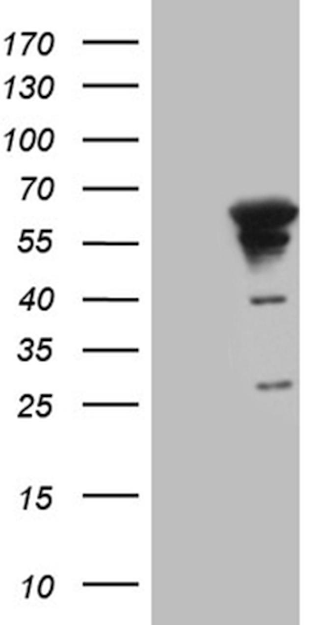 MYOT Antibody in Western Blot (WB)