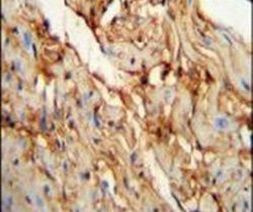 MYOZ1 Antibody in Immunohistochemistry (IHC)