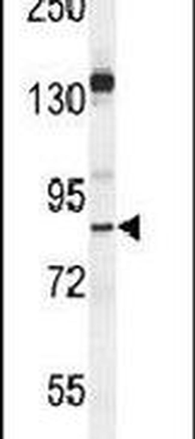 MYSM1 Antibody in Western Blot (WB)