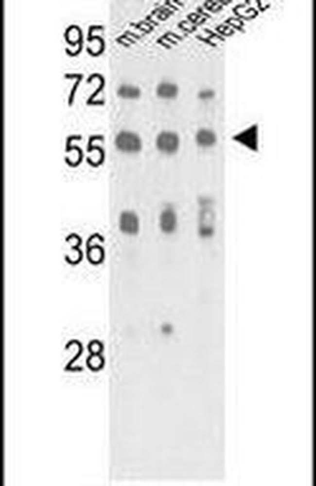 MECP2 Antibody in Western Blot (WB)