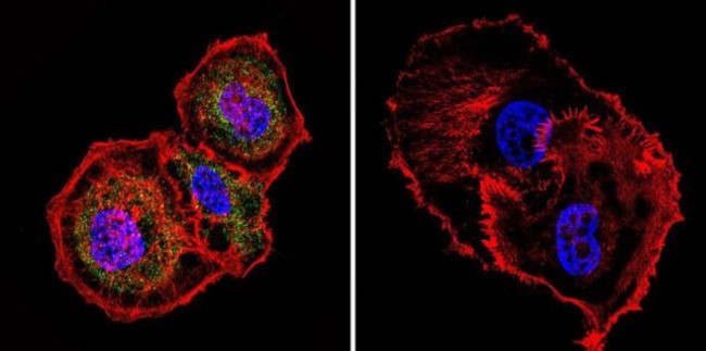 Mesothelioma Antibody in Immunocytochemistry (ICC/IF)