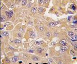 METAP2 Antibody in Immunohistochemistry (IHC)