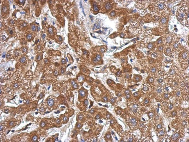 Kindlin 2 Antibody in Immunohistochemistry (IHC)