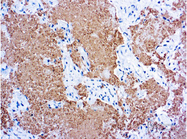 Pneumocystis Carinii Antibody in Immunohistochemistry (Paraffin) (IHC (P))