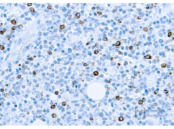 LMP-1 (Epstein-Barr Virus) Antibody in Immunohistochemistry (Paraffin) (IHC (P))
