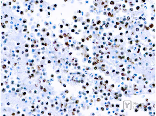 Herpesvirus 8 Antibody in Immunohistochemistry (Paraffin) (IHC (P))