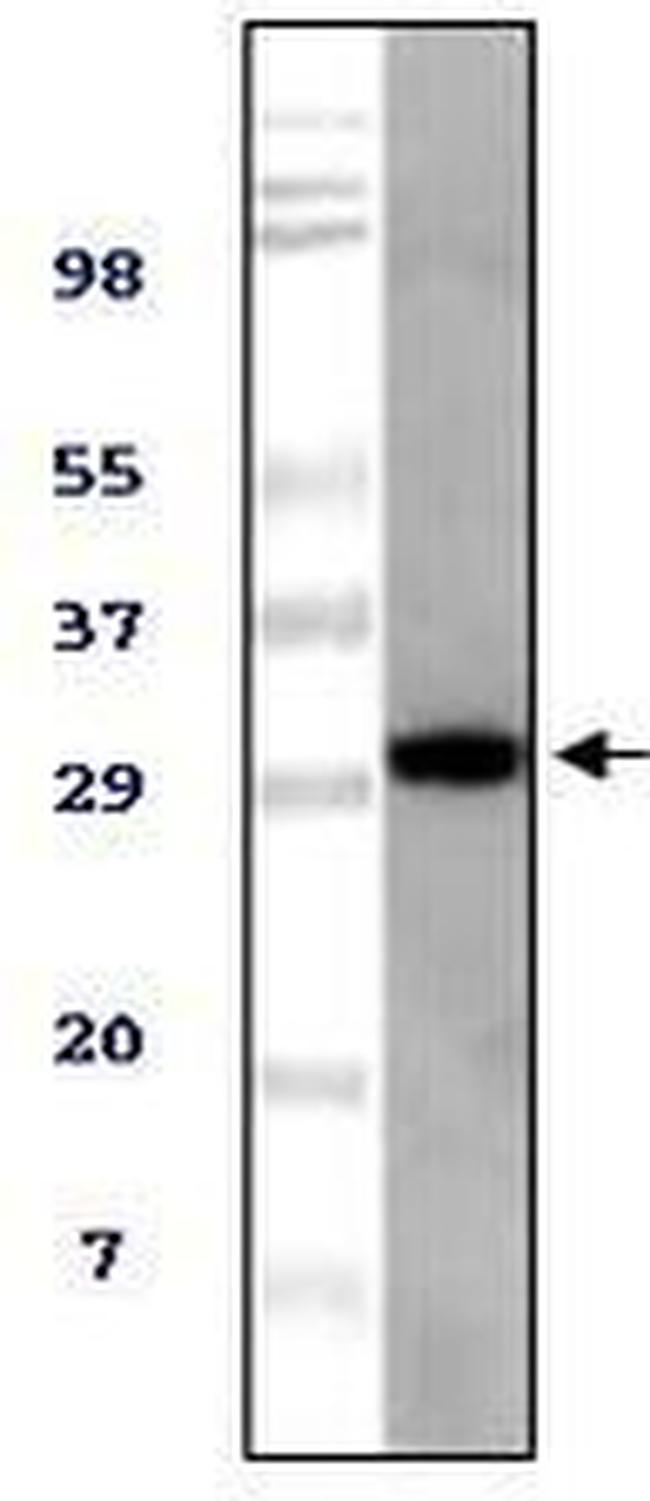 Tug Antibody in Western Blot (WB)