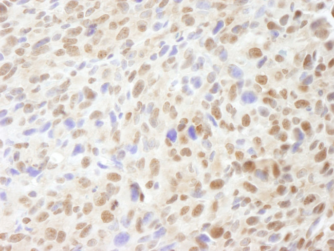 Mre11 Antibody in Immunohistochemistry (IHC)