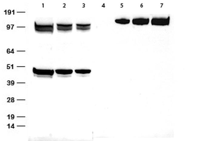 Myc tag Antibody in Western Blot (WB)