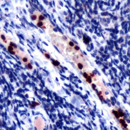 Myeloperoxidase Antibody in Immunohistochemistry (IHC)