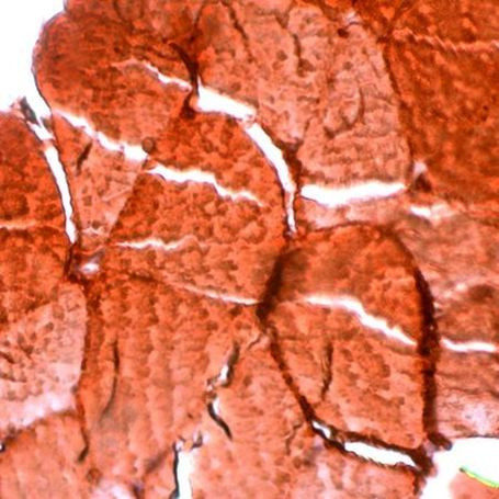 Myoglobin Antibody in Immunohistochemistry (IHC)