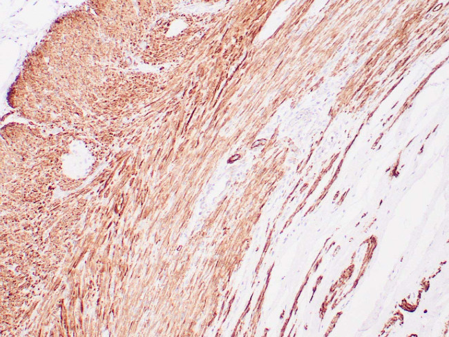 Myosin, SMHC Antibody in Immunohistochemistry (Paraffin) (IHC (P))