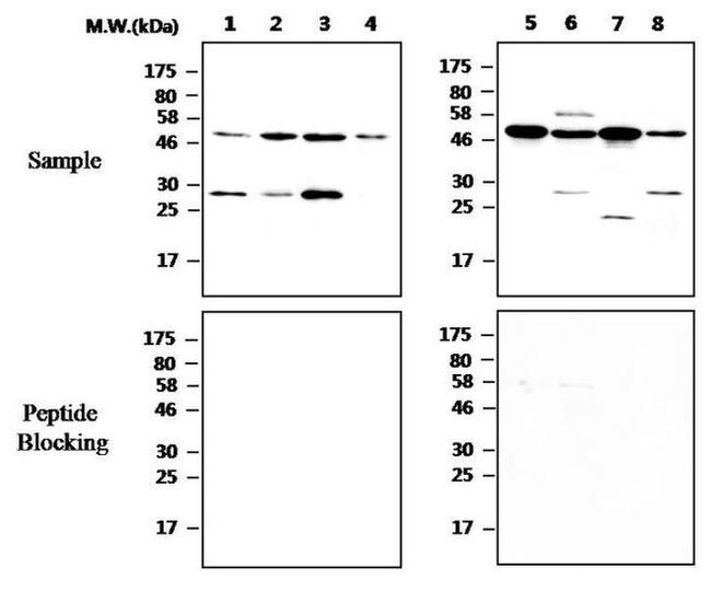 n-Myc Antibody in Western Blot (WB)