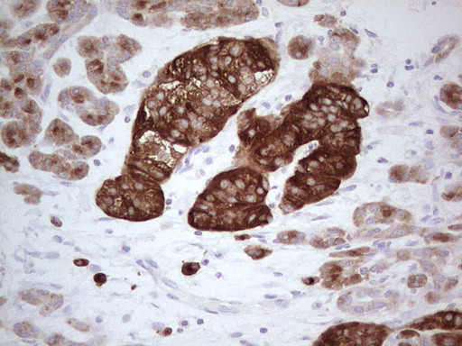 N4BP2L2 Antibody in Immunohistochemistry (Paraffin) (IHC (P))