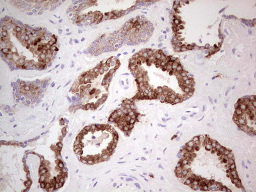 N4BP2L2 Antibody in Immunohistochemistry (Paraffin) (IHC (P))