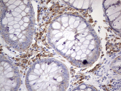N4BP2L2 Antibody in Immunohistochemistry (Paraffin) (IHC (P))