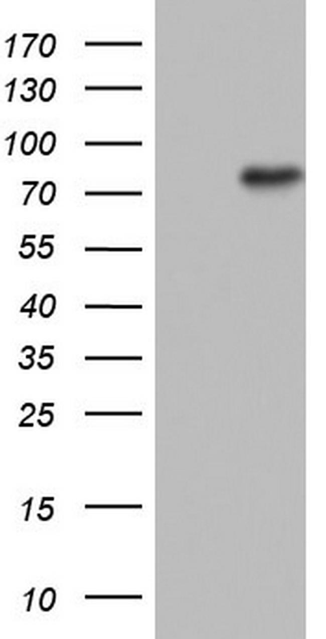 N4BP2L2 Antibody in Western Blot (WB)