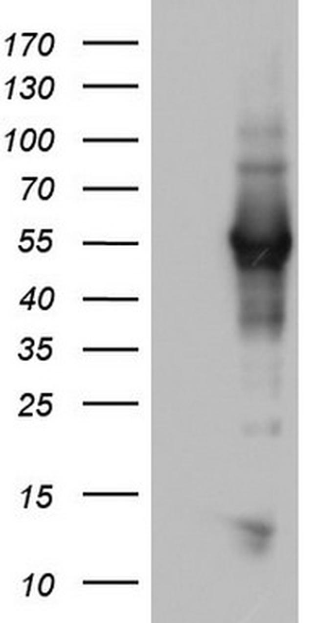 NAB1 Antibody in Western Blot (WB)
