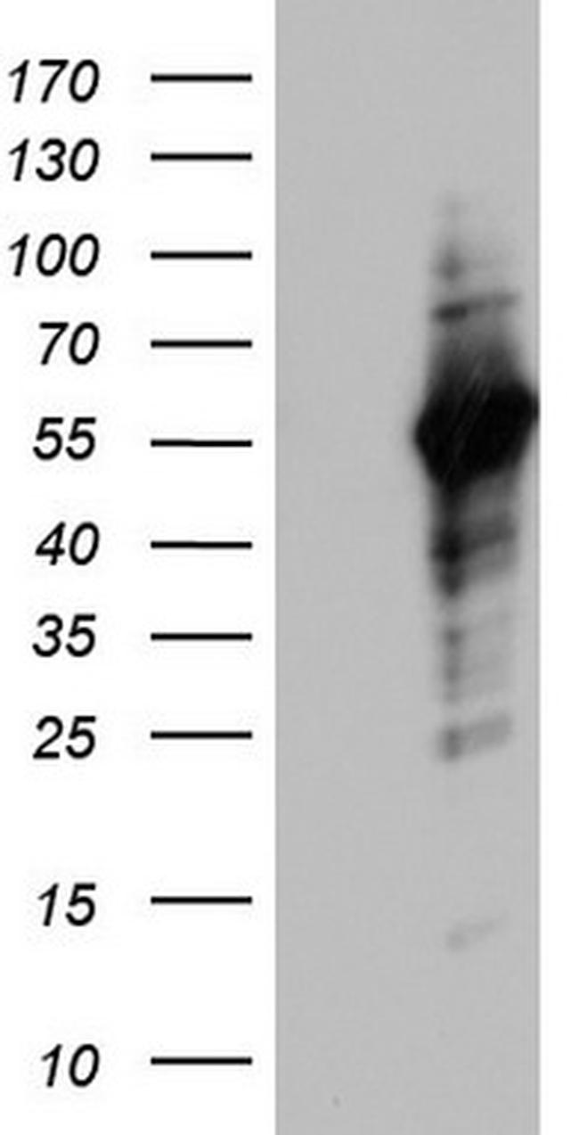 NAB1 Antibody in Western Blot (WB)