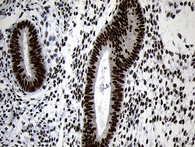 NABP1 Antibody in Immunohistochemistry (Paraffin) (IHC (P))