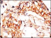 NAE1 Antibody in Immunohistochemistry (IHC)