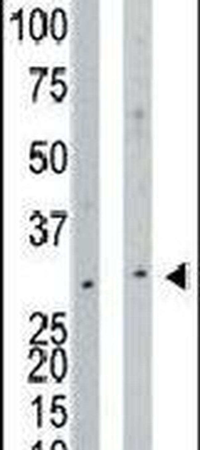 NAGK Antibody in Western Blot (WB)