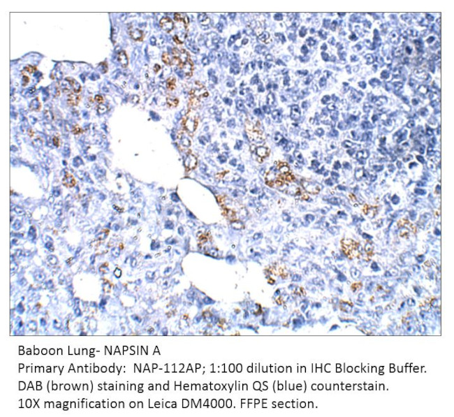 NAPSIN A Antibody in Immunohistochemistry (IHC)