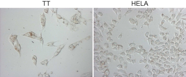 NAPSA Antibody in Immunocytochemistry (ICC/IF)