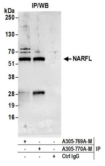 NARFL Antibody in Immunoprecipitation (IP)