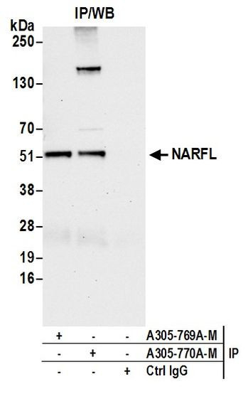 NARFL Antibody in Immunoprecipitation (IP)