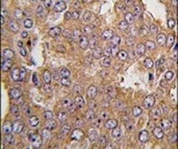 NARS2 Antibody in Immunohistochemistry (IHC)