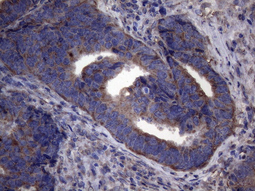 NARS2 Antibody in Immunohistochemistry (Paraffin) (IHC (P))