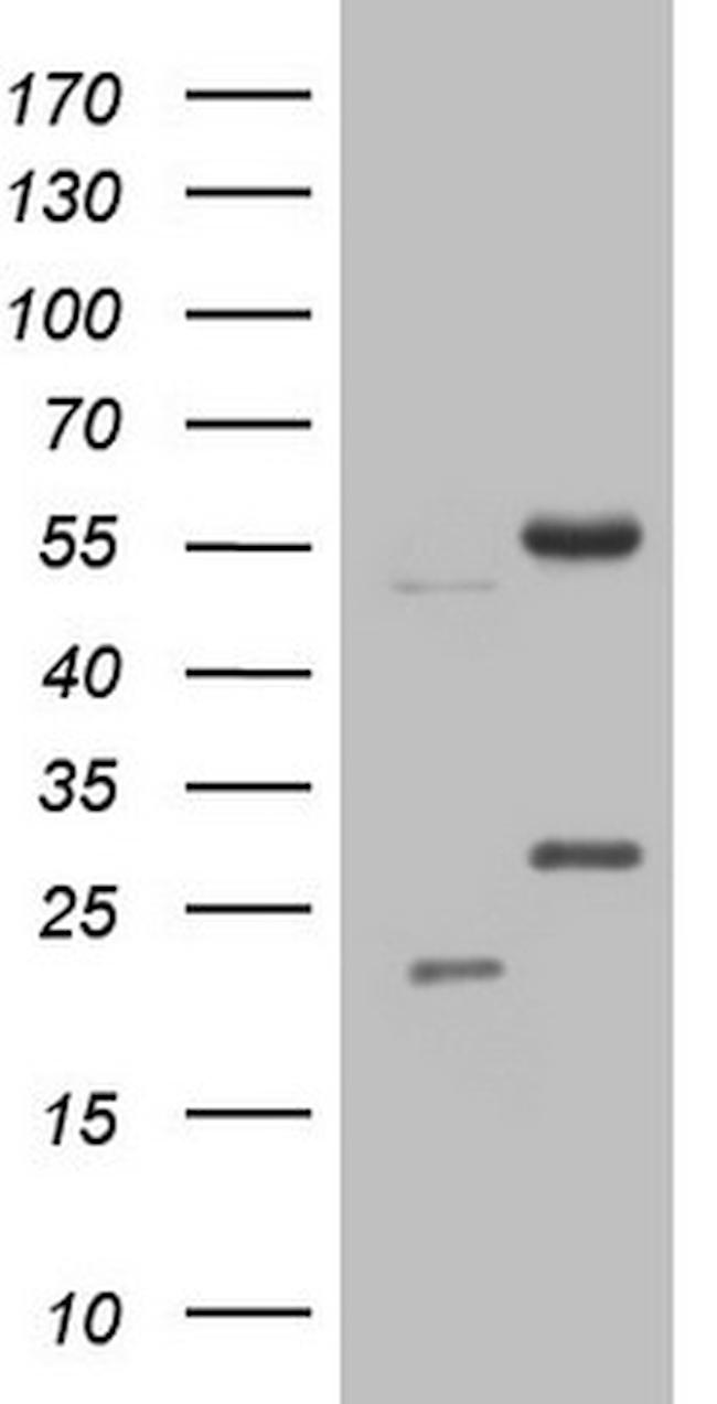 NARS2 Antibody in Western Blot (WB)