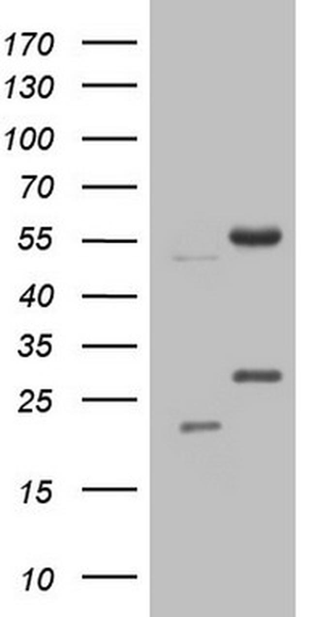 NARS2 Antibody in Western Blot (WB)