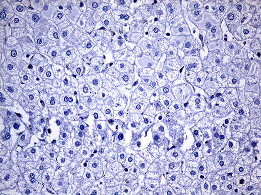 NAT1 Antibody in Immunohistochemistry (Paraffin) (IHC (P))