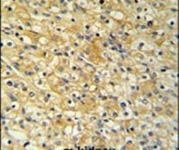 NAT8 Antibody in Immunohistochemistry (IHC)