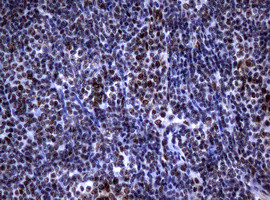 NBN Antibody in Immunohistochemistry (Paraffin) (IHC (P))